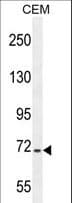 GOK / STIM1 Antibody (aa509-538)