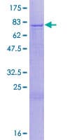 Human KATNAL2 Protein (Recombinant GST)
