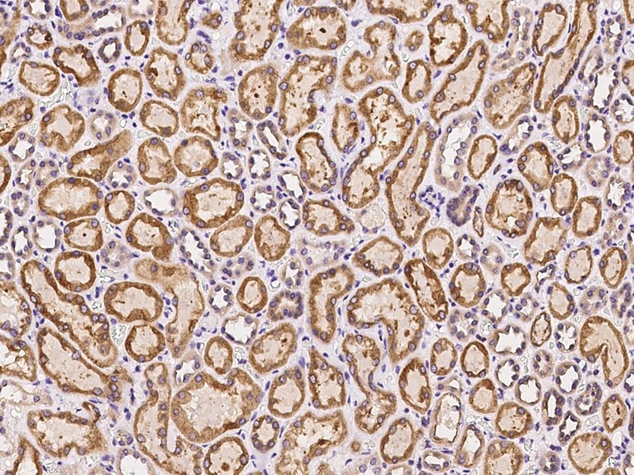 CYPOR / POR Antibody