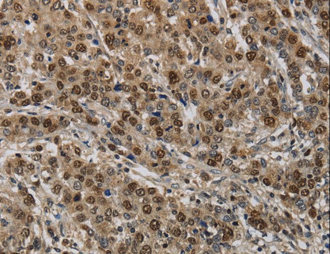 KIF4A Antibody