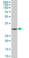 DECR1 Antibody (clone 3D4)
