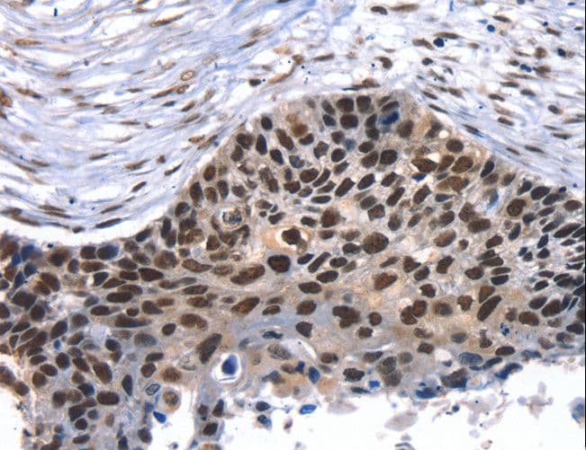 TAF15 Antibody