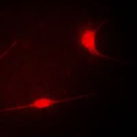 LIMK1 / LIMK Antibody (Internal)