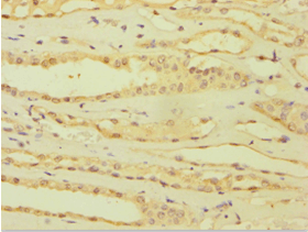 ATP5J Antibody (aa1-108)