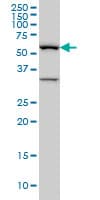 IHC-plus™ BAIAP2L1 Antibody (clone 2A4)