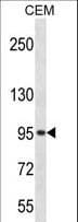 ADRBK2 / GRK3 Antibody (aa524-552)