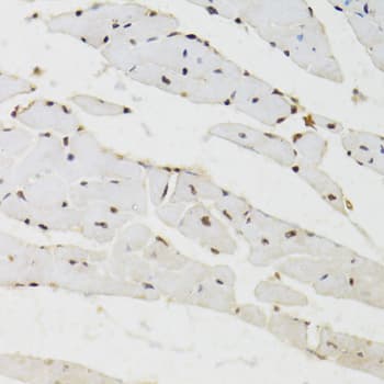 BAZ1B / WSTF Antibody