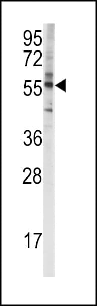 Polyclonal Rabbit anti-Human CYP4F8 Antibody (aa473-503, WB)