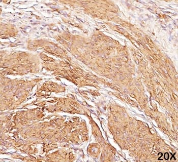 Monoclonal Mouse anti-Human Actin Antibody (clone HHF35, Azide-free,BSA-free, IHC, IF, WB)