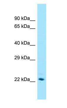 ST6GAL1 / CD75 Antibody (aa89-138)