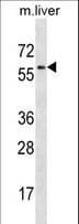 IHC-plus™ MAP2K7 / MEK7 Antibody (aa206-233)