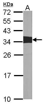 Polyclonal Rabbit anti-Human CRK Antibody (IF, WB)