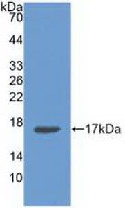 ANXA3 / Annexin A3 Antibody (aa26-160, Cy3)