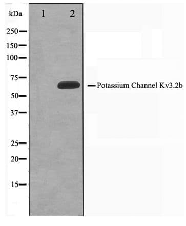 Polyclonal Rabbit anti-Human KCNC2 / Kv3.2 Antibody (IHC, WB)