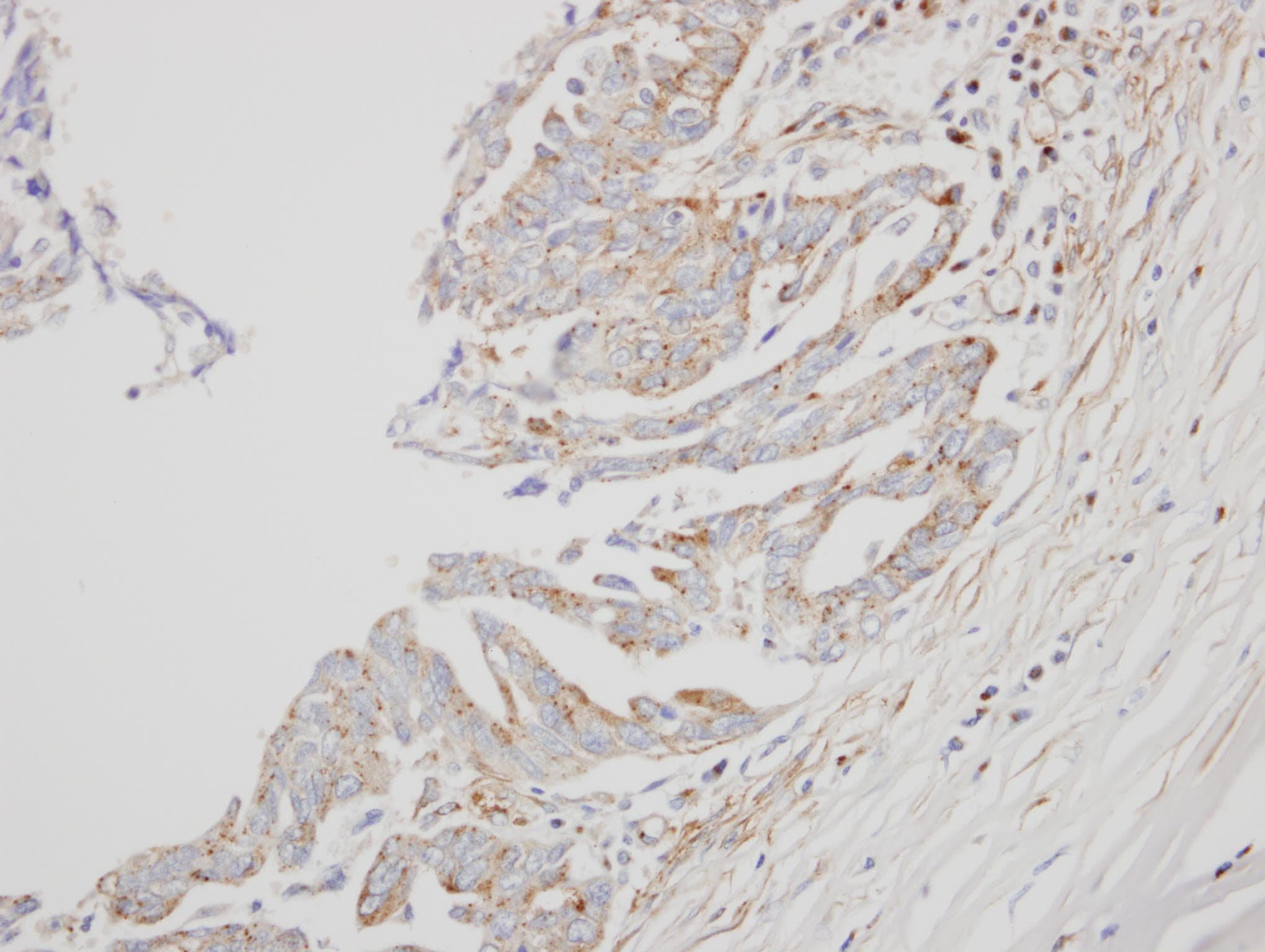 IFNA8 / Interferon Alpha 8 Antibody (aa1-189)