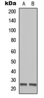 Polyclonal Rabbit anti-Human MOB1B / MOBKL1A Antibody (Internal, IHC, WB)