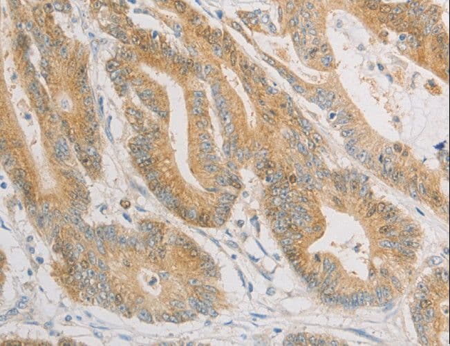 ZWINT Antibody