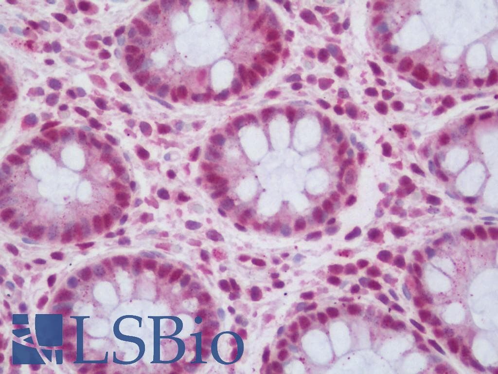 IHC-plus™ Polyclonal Rabbit anti-Human TRIP12 Antibody (aa75-125, IHC, WB)