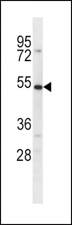 SLC39A14 / ZIP14 Antibody (aa29-58)