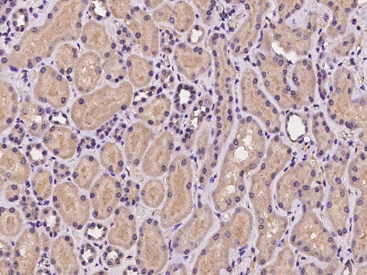 COMMD10 Antibody