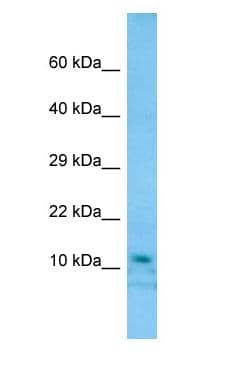 DDA1 Antibody (C-Terminus)