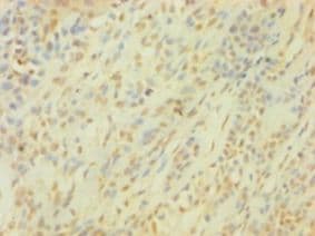 SNCG / Gamma-Synuclein Antibody (aa1-127)
