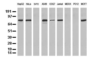 NBN / Nibrin Antibody (aa461-754, clone UMAB99)
