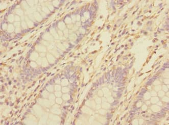 TNFAIP8 / SCC-S2 Antibody