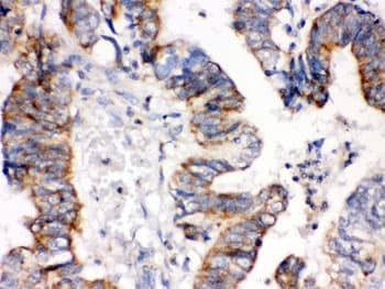 IGFBP3 Antibody