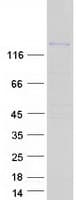 Human ARAP3 Protein (Recombinant Myc-DDK (Flag))