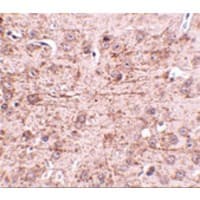 ZBTB1 Antibody