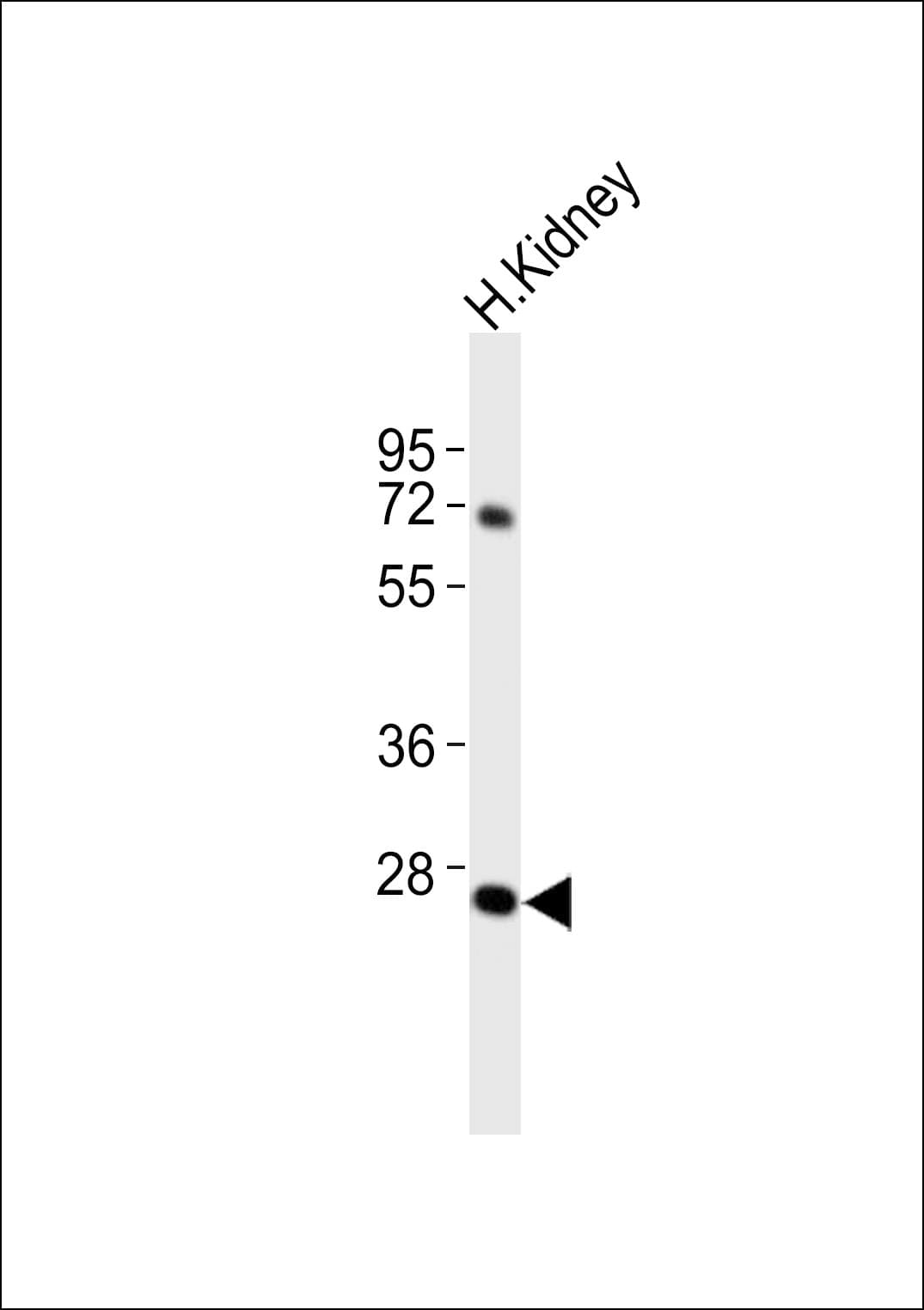 Polyclonal Rabbit anti-Human ABHD12B Antibody (WB)