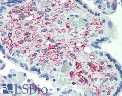 Polyclonal Rabbit anti-Human GDF11 / GDF-11 Antibody (aa299-407, IHC, WB)