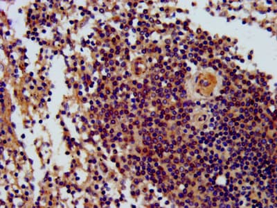 THOC5 Antibody