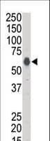 KSR1 Antibody (aa1-30)