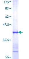 Human DDX18 Protein (Recombinant GST, N-terminus)
