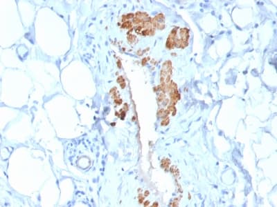PathPlus™ SMMHC / MYH11 Antibody (clone MYH11/2303R)