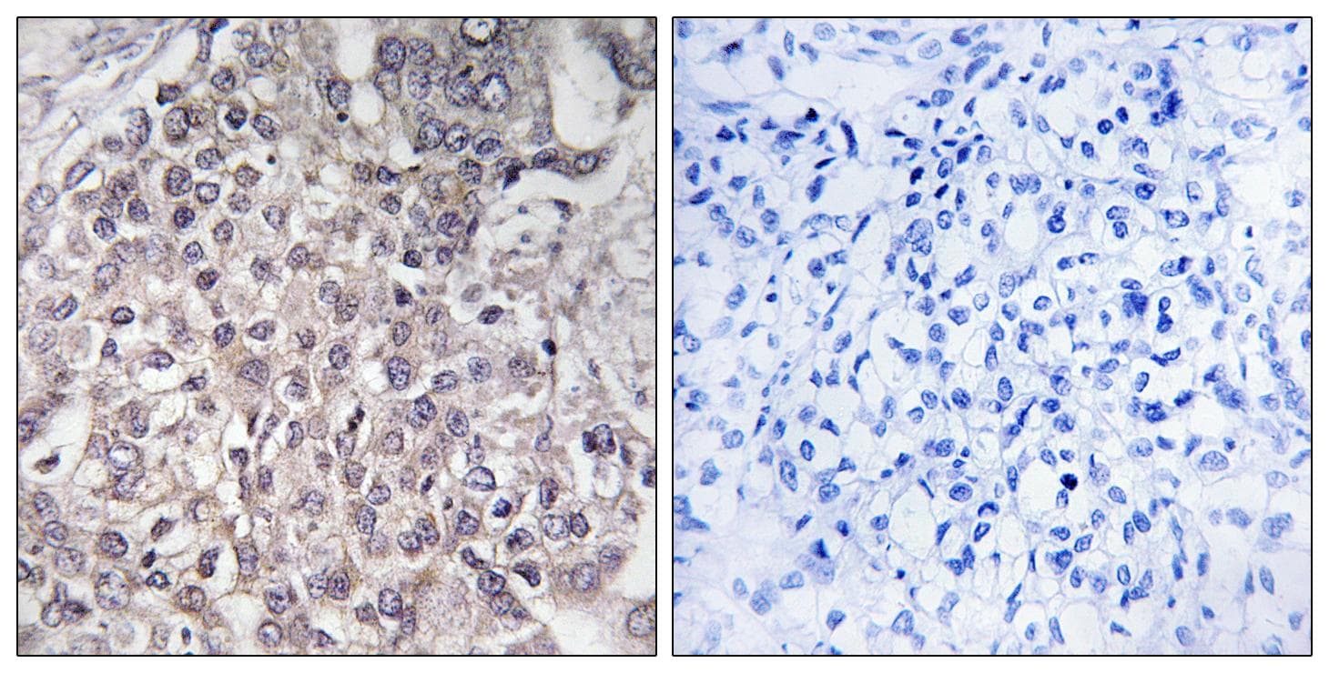 CYP4F2 Antibody