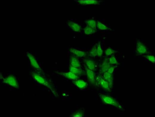 ASH1L / ASH1 Antibody