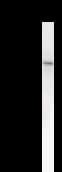 Monoclonal Mouse anti-Human SECISBP2 / SBP2 Antibody (clone 2957C2a, WB)