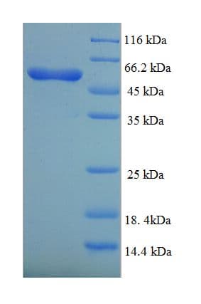 Human ALK3 / BMPR1A Protein (Recombinant His-SUMO)