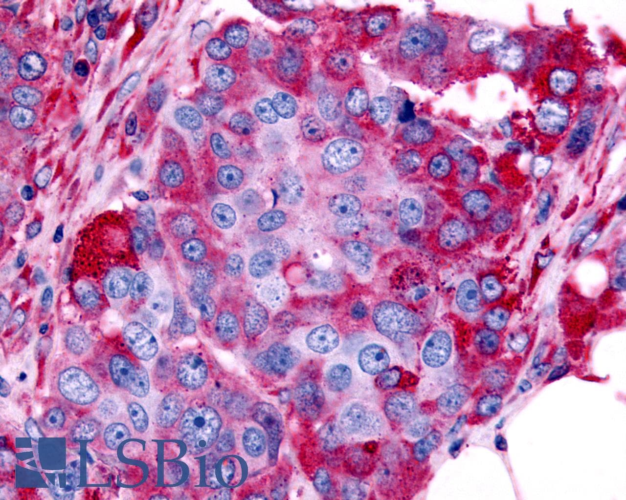 PathPlus™ Polyclonal Rabbit anti-Human ADRA1B / Adrenoceptor alpha 1B Antibody (Cytoplasmic Domain, IHC)