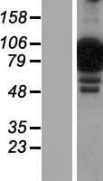 NCKIPSD / AF3P21 Protein (Over-Expression Lysate Myc-DDK (Flag))