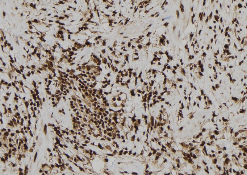 Zyxin Antibody