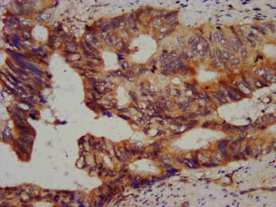 Vps60 / CHMP5 Antibody (aa1-219)