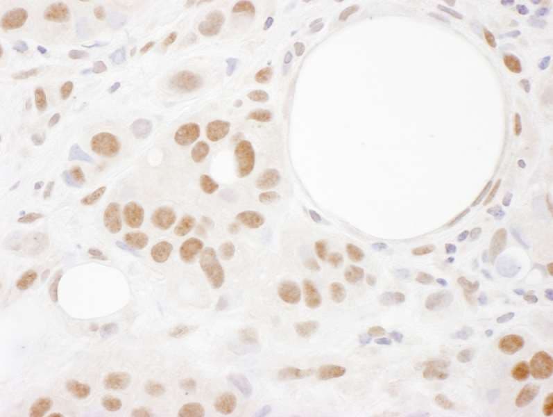 Polyclonal Goat anti-Human FUS / TLS Antibody (aa1-50, IHC, WB)