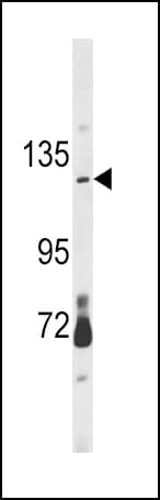 Polyclonal Rabbit anti-Human CLEC16A / KIAA0350 Antibody (aa365-391, WB)