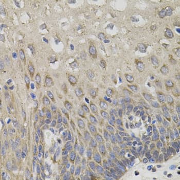 TNF Alpha Antibody