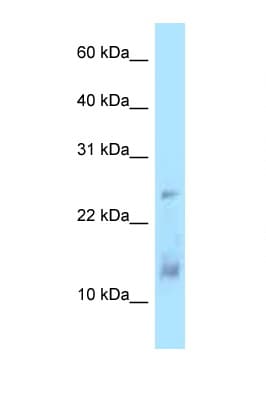 Polyclonal Rabbit anti-Human DYNLL1 / PIN Antibody (aa33-82, WB)