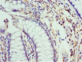 PELI1 / Pellino 1 Antibody (aa1-250)